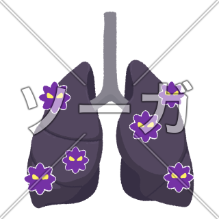 肺がんのイラスト